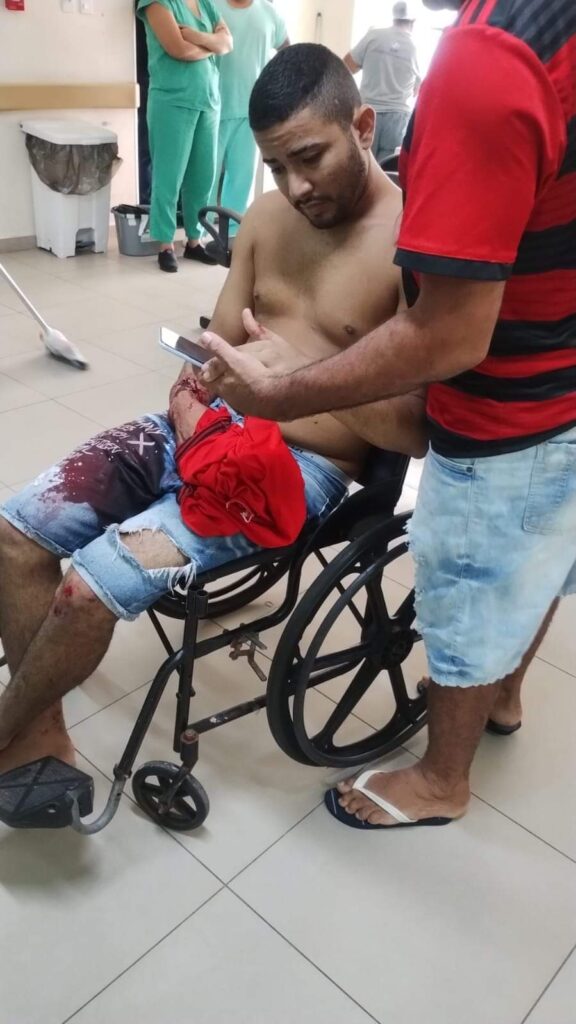 BELÉM: Delegado da Policia Civil intervém em um assalto perpetrado por dois elementos, e um dos bandidos acaba baleado e preso (foto abaixo).