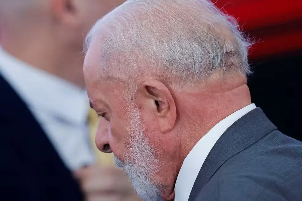 Lula passará nessa quinta por novo procedimento para complementar cirurgia na cabeça